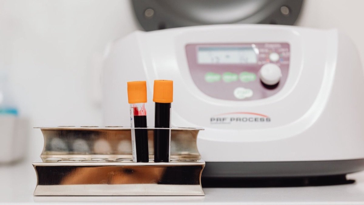Blood sample tubes in a laboratory rack ready for testing