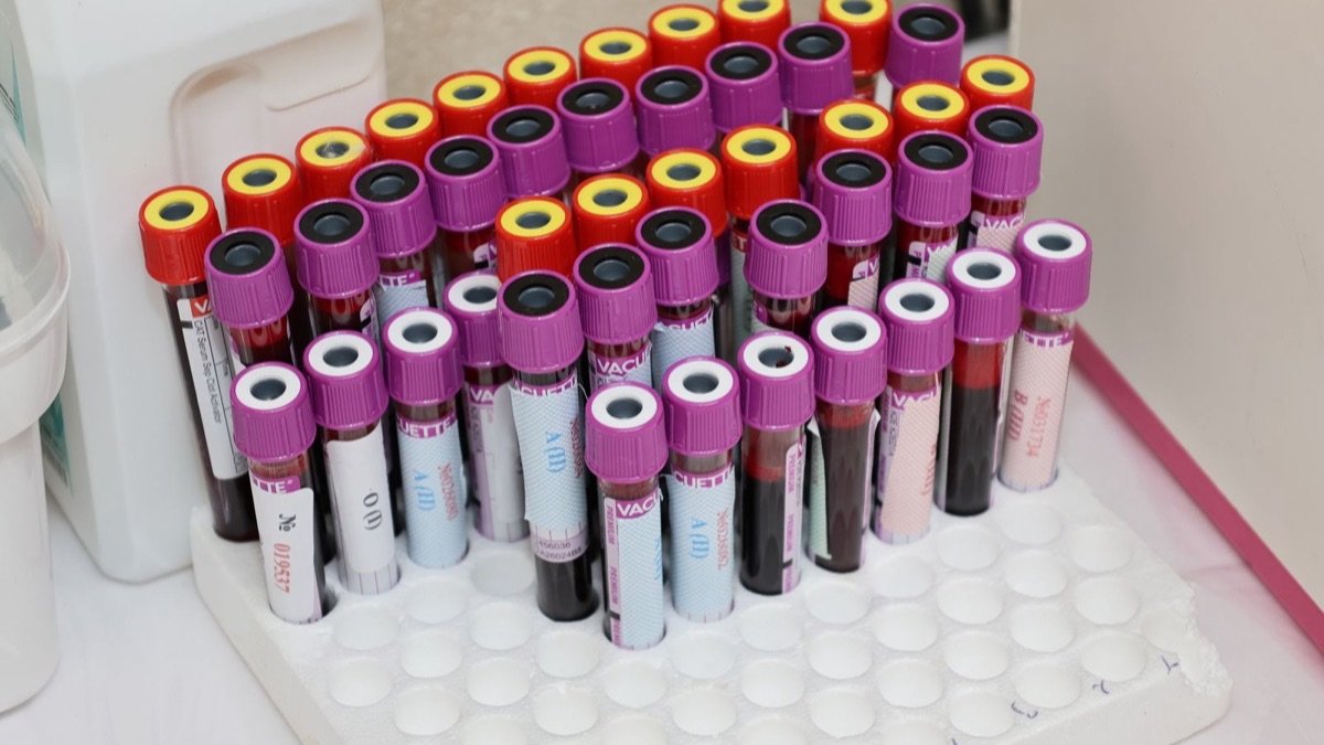 Rows of blood sample vials in a laboratory ready for analysis